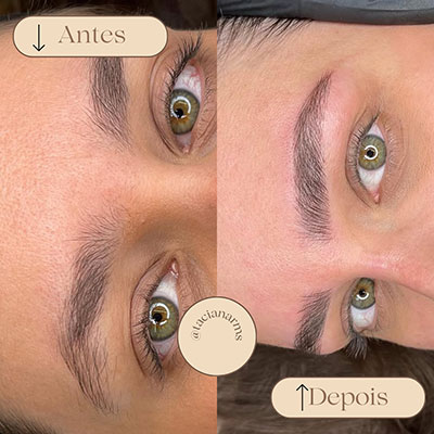 Antes/Depois da Micropigmentação Essence Brow