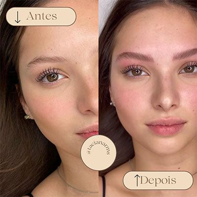 Antes/Depois da Micropigmentação Essence Brow