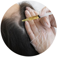 Tratamento Mesocapilar